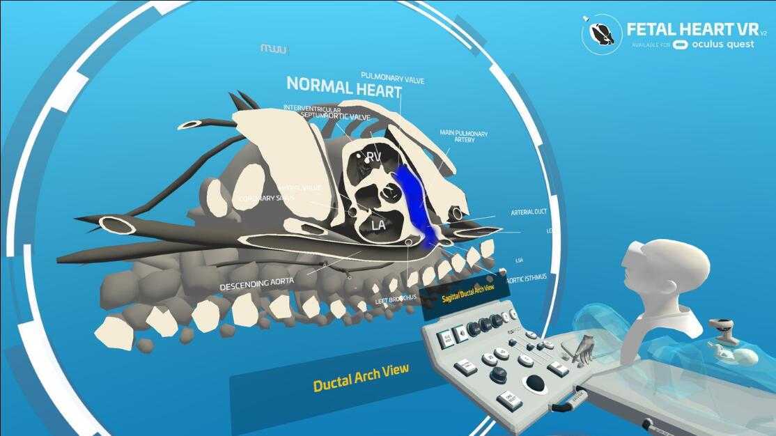 心脏病医学VR(Fetal Heart VR)- Oculus Ques